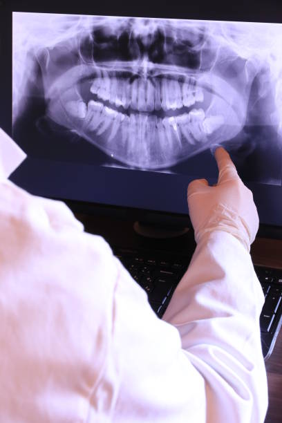 Best Emergency Tooth Extraction in Bradford, OH