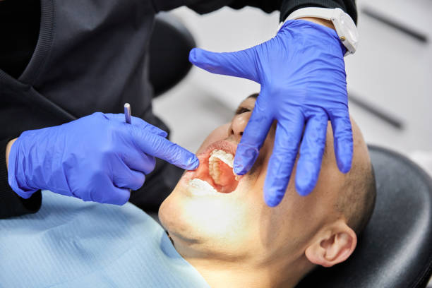 Best Emergency Denture Repair in Bradford, OH
